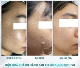 hướng dẫn sử dụng peel da không bong loại nào tốt