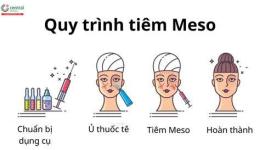 hướng dẫn sử dụng tiêm căng bóng da meso