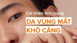 hướng dẫn sử dụng vùng da quanh mắt bị khô bong tróc