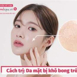 mặt khô bong da