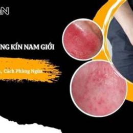 ngứa bong da vùng kín nam giới