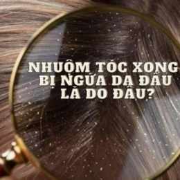 nhuộm tóc xong bị bong da đầu
