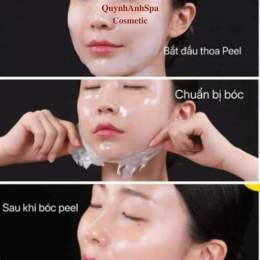 peel căng bóng da