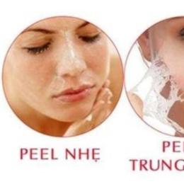peel da bong tróc