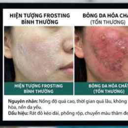 tại sao da bị bong tróc