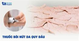 tính năng nổi bật bao quy đầu bị khô bong da