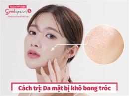 tính năng nổi bật bị bỏng tróc da phải làm sao