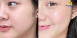 tính năng nổi bật cách làm da căng bóng tại nhà