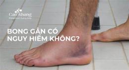 tính năng nổi bật cách trị bong da tay