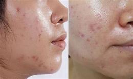 tính năng nổi bật da chân bóng loáng