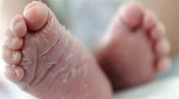 tính năng nổi bật da chân bong tróc là bệnh gì