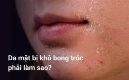tính năng nổi bật da đầu khô bong tróc mùa đông