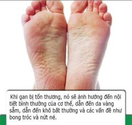tính năng nổi bật da gót chân bị bong tróc
