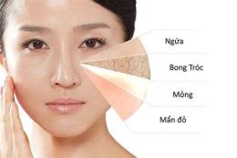 tính năng nổi bật da mặt khô sần sùi bong tróc