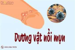 tính năng nổi bật dương vật bị bong da có sao không