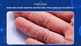 tính năng nổi bật ngón tay bong tróc da