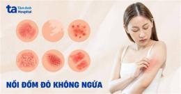 tính năng nổi bật nổi bóng nước trên da là bệnh gì