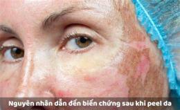 tính năng nổi bật peel bong da mặt
