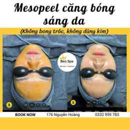 tính năng nổi bật peel da k bong