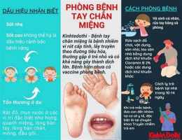 tính năng nổi bật trẻ 3 tuổi bị bong da tay chân