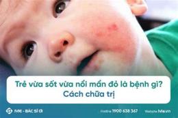 tính năng nổi bật trẻ sốt da nổi bông