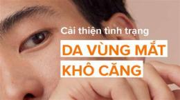 tính năng nổi bật vùng da quanh mắt bị khô bong tróc