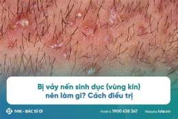 tính năng nổi bật vùng kín bị khô bong da