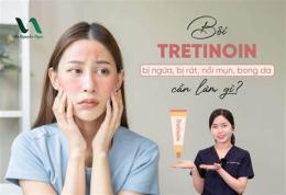 tính năng nổi bật xài tretinoin bị bong da