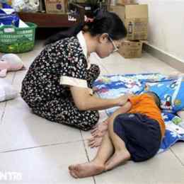 trẻ 3 tuổi bị bong da tay chân
