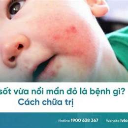 trẻ sốt da nổi bông