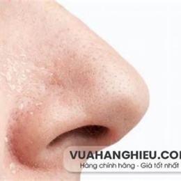 vùng da quanh mũi bị khô bong tróc