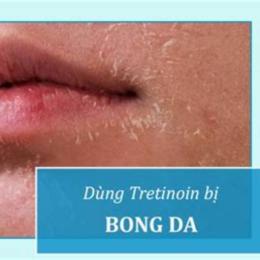 xài tretinoin bị bong da